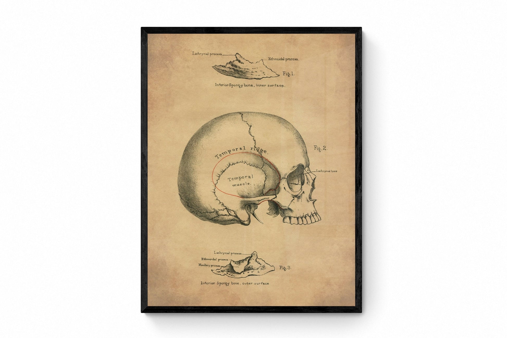 Skull Print - Osteology - Antique Reproduction - Science - Anatomy - Medical Decor - Skeleton - Available Framed