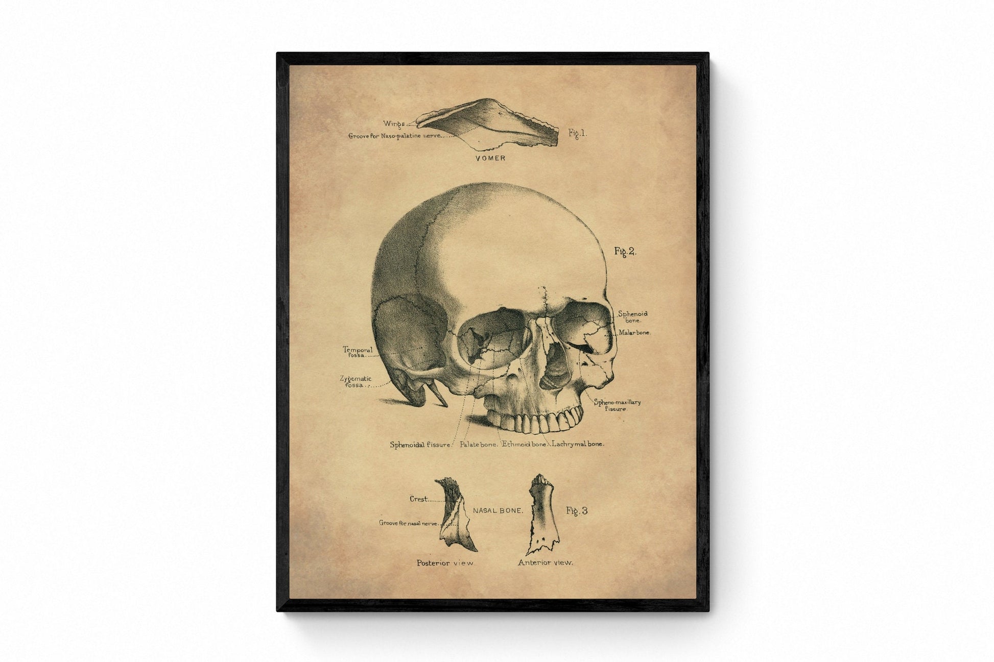 Skull Print - Osteology - Antique Reproduction - Science - Anatomy - Medical Decor - Skeleton - Available Framed